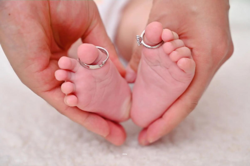 海南孕妇怎样预防妊娠纹